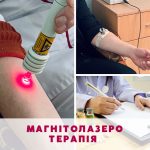 магнітолазерна терапія